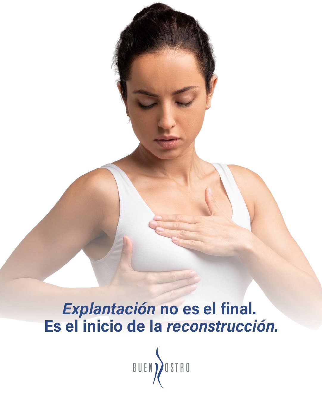 La explantación mamaria no es el final, es el inicio de una nueva etapa ✨
Con una evaluación preoperatoria exhaustiva, la definición precisa de la técnica quirúrgica y una correcta preparación de la paciente 🩺📋, planificamos cada detalle para que este proceso sea seguro y armonioso 🤍