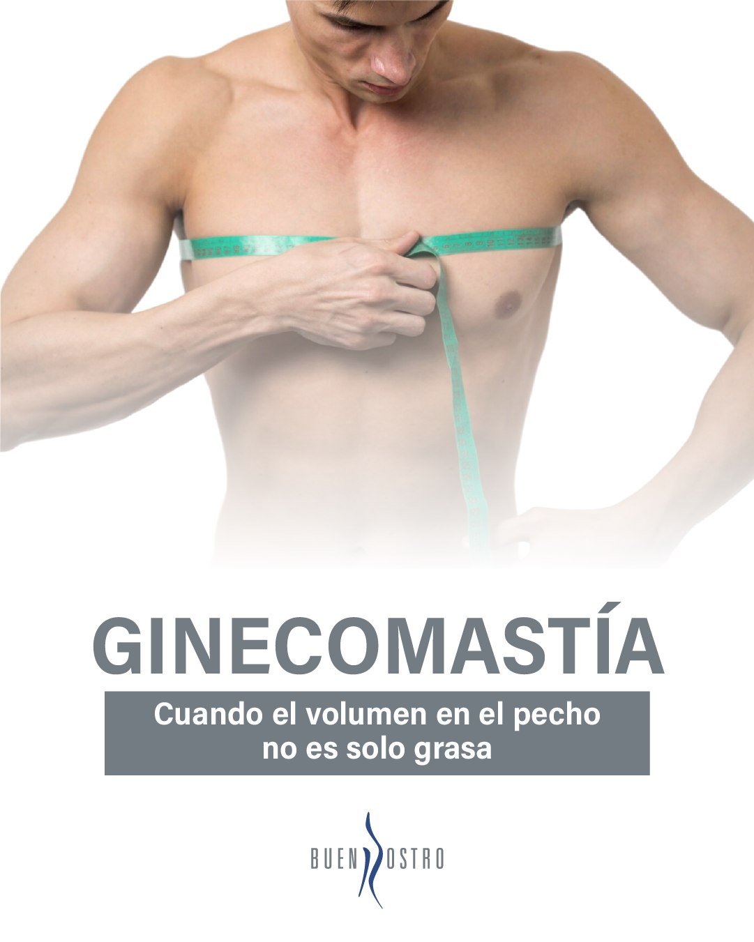 Cuando el volumen en el pecho no es solo grasa, hacer ejercicio no siempre lo corrige. 👨⚕️
La ginecomastia requiere una valoración precisa para definir el tratamiento adecuado.
📩 Agenda una consulta y conoce el tratamiento adecuado para ti.