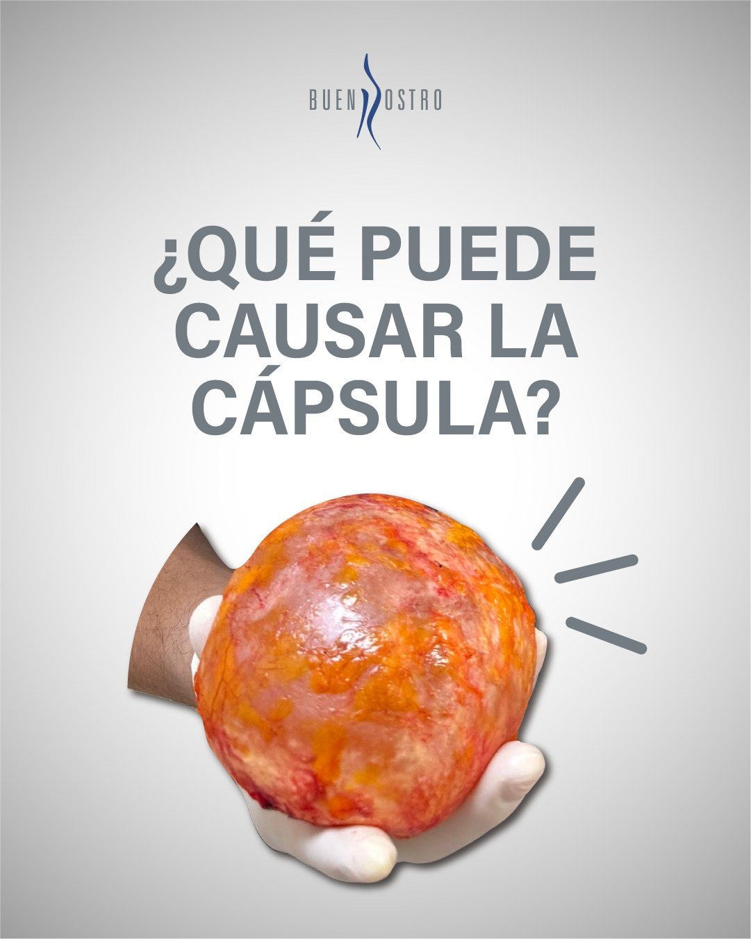 La cápsula no siempre se comporta de la misma manera. Algunas alteraciones poco conocidas también pueden requerir atención especializada. 🔬🩺

Conocerlas a tiempo puede hacer una gran diferencia en la decisión médica.

📩 Agenda una valoración y aclara todas tus dudas.