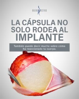 🧠 La cápsula no solo rodea al implante… también habla de cómo reacciona tu cuerpo.

Ignorarla puede ser ignorar información importante.

📩 Infórmate antes de tomar decisiones sobre tus implantes.