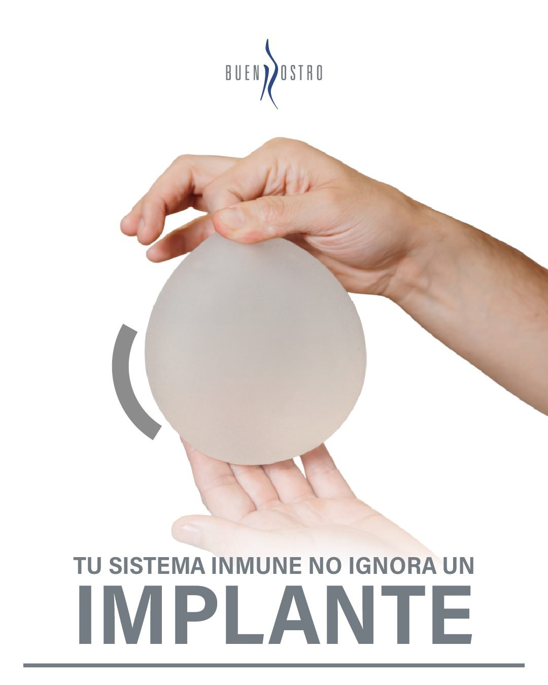 Tu sistema inmune no “ignora” un implante.

Desde el momento en que se coloca, el cuerpo genera una respuesta natural alrededor de él. ✨

Por eso, algunas pacientes comienzan a presentar cambios físicos o molestias con el paso del tiempo, haciendo necesaria una valoración especializada. 

📩 Agenda tu valoración.

CE: 244898 AVISO DE PUBLICIDAD: 2414102002A00654