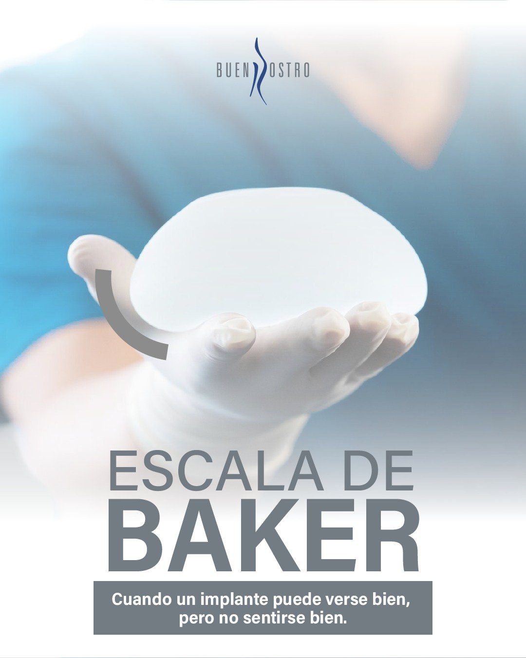 No todas las molestias después de un aumento mamario se presentan igual.

La escala de Baker ayuda a clasificar el grado de contractura capsular y evaluar cuándo un implante puede estar generando cambios o incomodidad. ✨

📩 Agenda tu valoración.

CE: 244898. AVISO DE PUBLICIDAD: 2414102002A00654