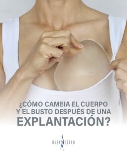 Después de una explantación mamaria, el cuerpo sí cambia… y entender ese proceso también es parte de tomar una decisión informada. ✨

La calidad de la piel, el tiempo de los implantes y las características de cada paciente influyen en cómo se verá el busto después del procedimiento. 

📩 Agenda tu valoración.

CE: 244898 AVISO DE PUBLICIDAD: 2414102002A00654