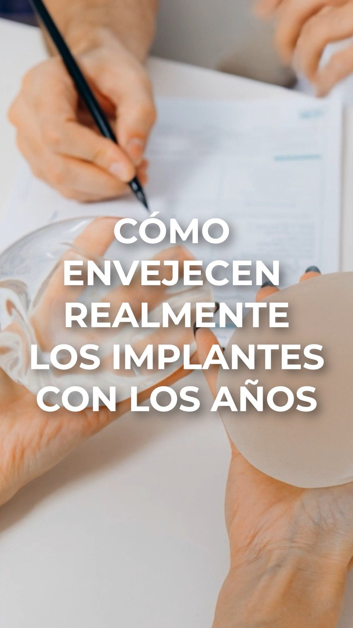 Los implantes mamarios no están diseñados para durar “toda la vida”. ⏳
Con el paso del tiempo, pueden presentar desgaste, cambios en su cubierta, contractura capsular, ruptura o generar molestias que muchas pacientes no relacionan de inmediato.Por eso, el seguimiento médico no debe olvidarse después de la cirugía.👨⚕️
Si tienes implantes desde hace años, una valoración puede ayudarte a conocer su estado actual.
CE: 244898. AVISO DE PUBLICIDAD: 2414102002A00654